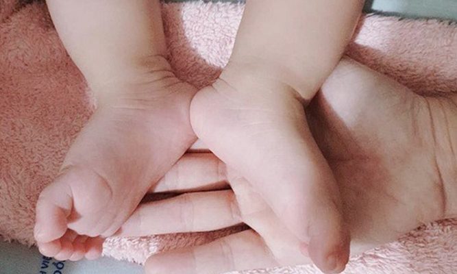 Mẹ nâng niu bàn chân của Trúc Nhi. Ảnh bệnh viện cung cấp.