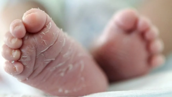 Những hiện tượng sinh lý đặc biệt này ở trẻ sơ sinh khiến cha mẹ lo sợ, nhưng chúng là bình thường - Ảnh 1. Những hiện tượng sinh lý đặc biệt này ở trẻ sơ sinh khiến cha mẹ lo sợ, nhưng chúng là bình thường - Ảnh 1.