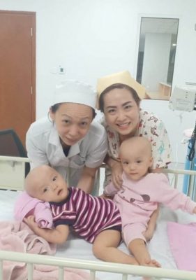 Các điều dưỡng chơi đùa với hai bé trước giờ phẫu thuật, ngày 15/7. Ảnh: Bệnh viện cung cấp